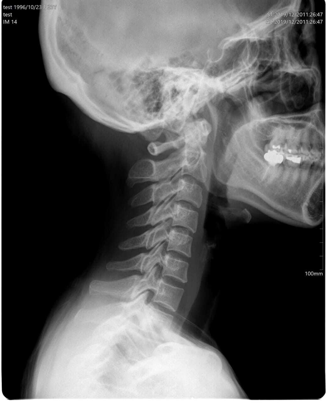 Computed Radiography Color Code: Whire