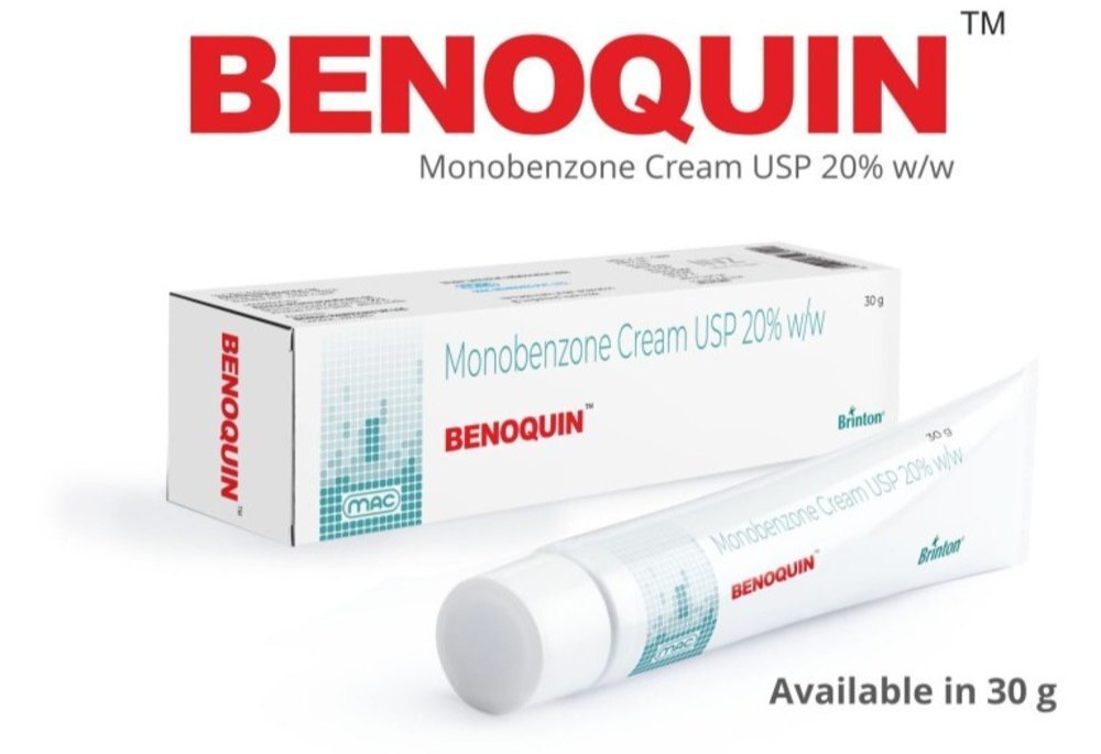 Benoquin Monobenzone Cream - 100g, Skin Whitening For Vitiligo Treatment, External Use For Adults And Women
