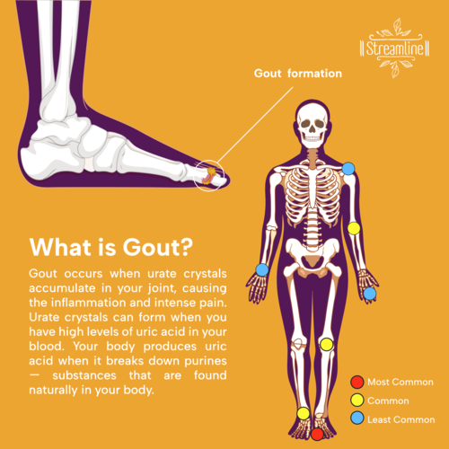 Streamline Uric Acid  Treatment - Age Group: For Adults