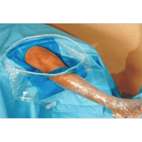 आर्थ्रोस्कोपी ड्रेप - वोने हेल्थ केयर