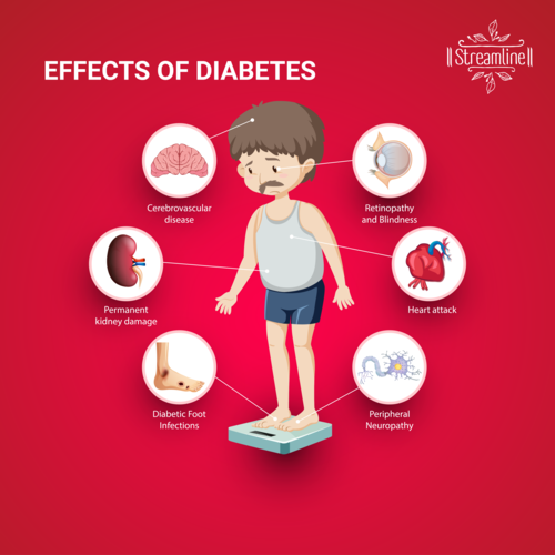 Dabicut Capsule For Diabetes - Product Type: Ayurvedic Medicine