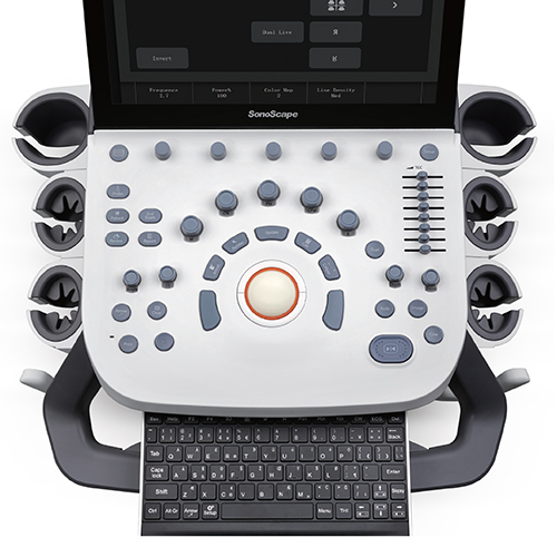 P9 Trolley Color Doppler Ultrasound Machine - Material: Steel & Pvc