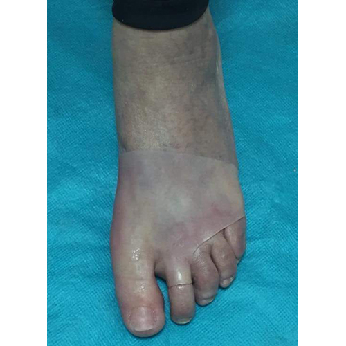 Human Silicone Foot - Soft Natural Silicone Material | Commercial Application, Realistic Feel
