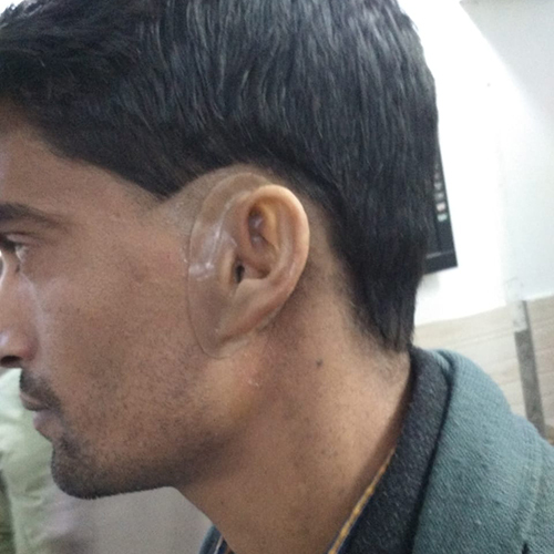 Human Silicone Ear - Application: Commercial