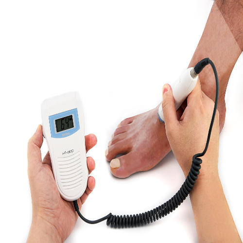 Vascular Doppler - 5 8 Mhz Frequency | Lightweight Ergonomic Design Lcd Display Audio Output Auto Shut-off Long Battery Life