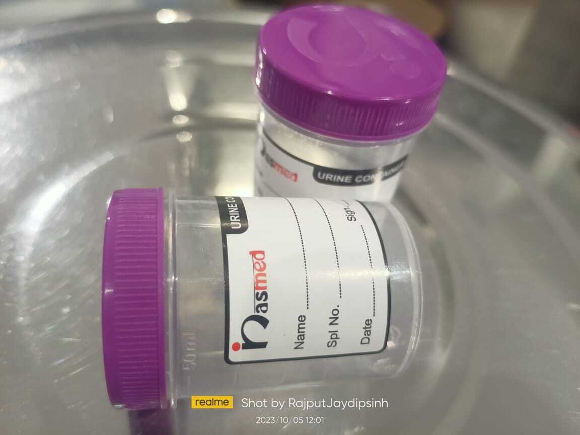 Nasmed Sterile Urine Container-50ml