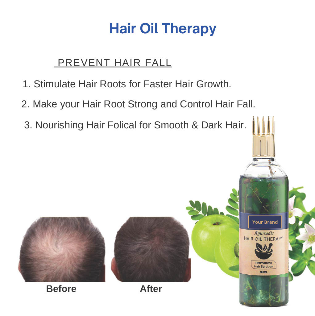 Herbal Hair Oil Therapy 200 Ml - Natural Oil, 24 Months Shelf Life | Recommended For Males & Females, Reduces Hair Fall, Boosts Hair Growth