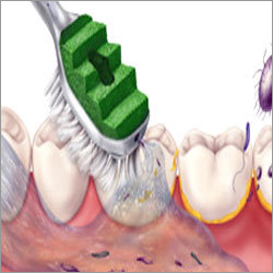 मौखिक देखभाल चूसक टूथब्रश