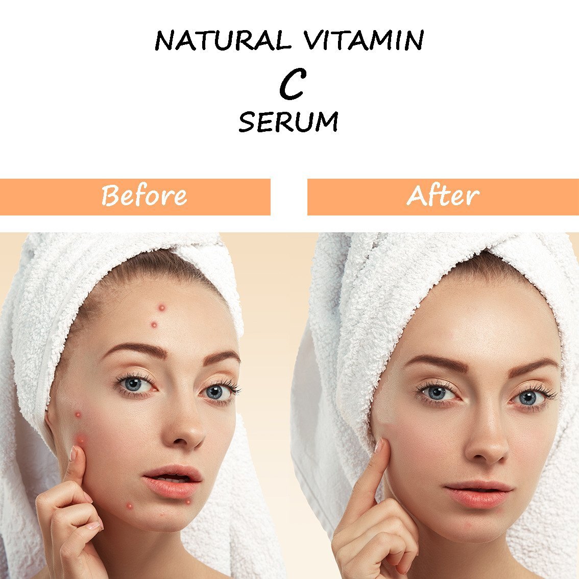 Swosh Vitamin C Face Serum 30 Ml - Liquid Formula, Herbal Ingredients | Boosts Brightness, Fights Wrinkles, Evens Skin Tone, Protects Against Sun Damage