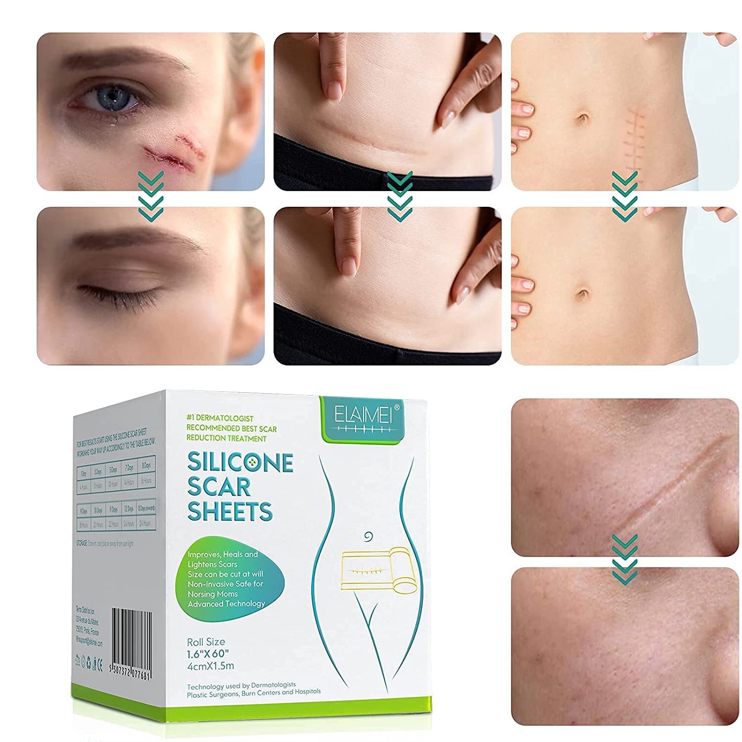Silicone Gel Strips Patch