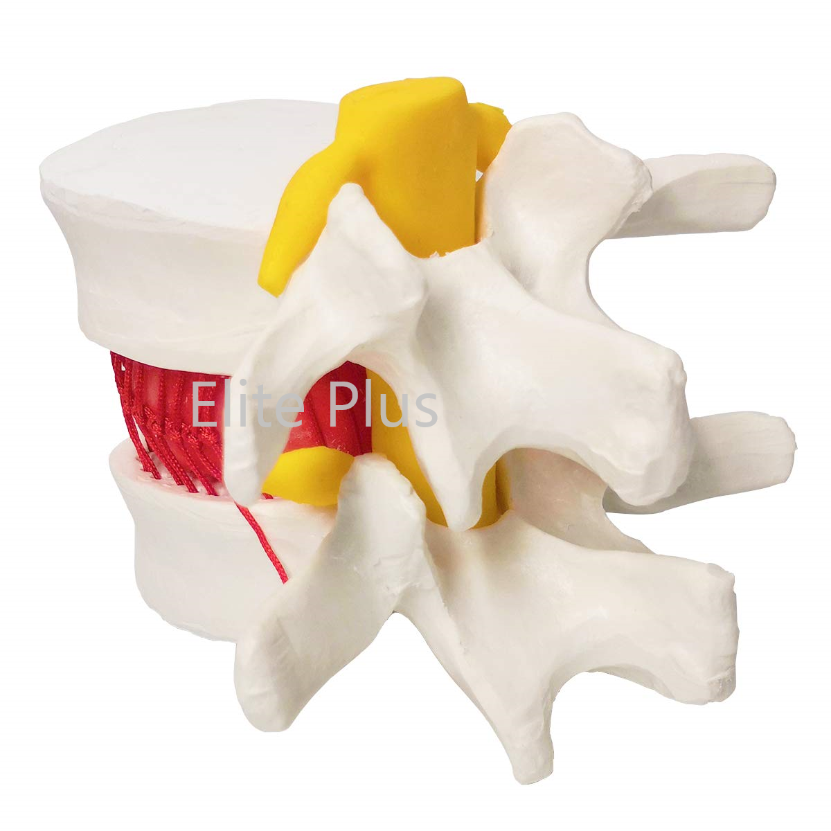 Zx-1504 Functioning Prolapsed Lumbar Vertebrae Model - Color: Ivory