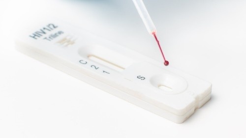 Hiv Test Kits - Attributes: Higher Level Of Accuracy