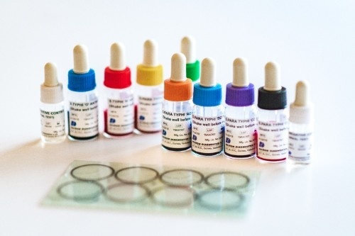 Serology Reagents & Strips - Plastic, Direct Latex Agglutination & Slide Agglutination Tests | Easy To Operate, Higher Level Of Accuracy, Safe To Use