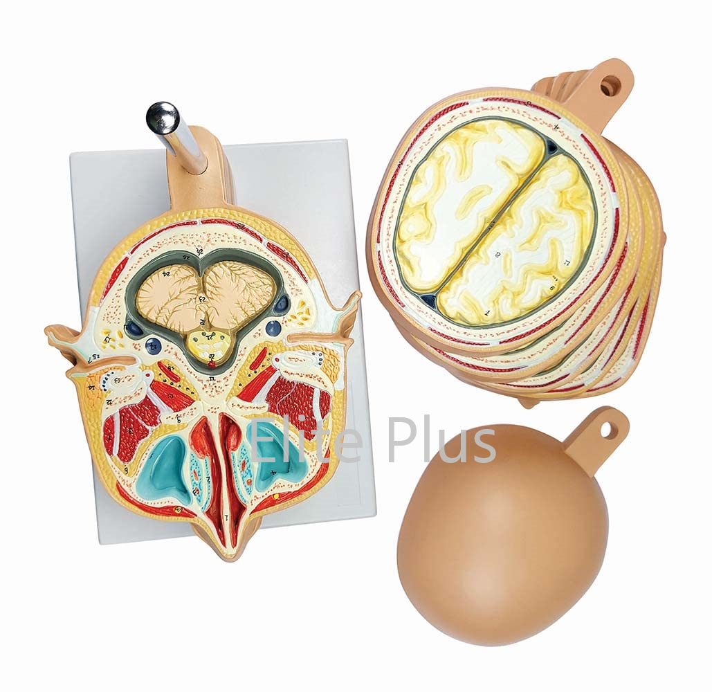 Zx-1433pn Sliced Head Model, 12 Slices - Color: Multicolor