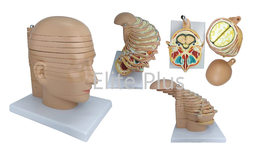 Zx-1433pn Sliced Head Model, 12 Slices - Color: Multicolor