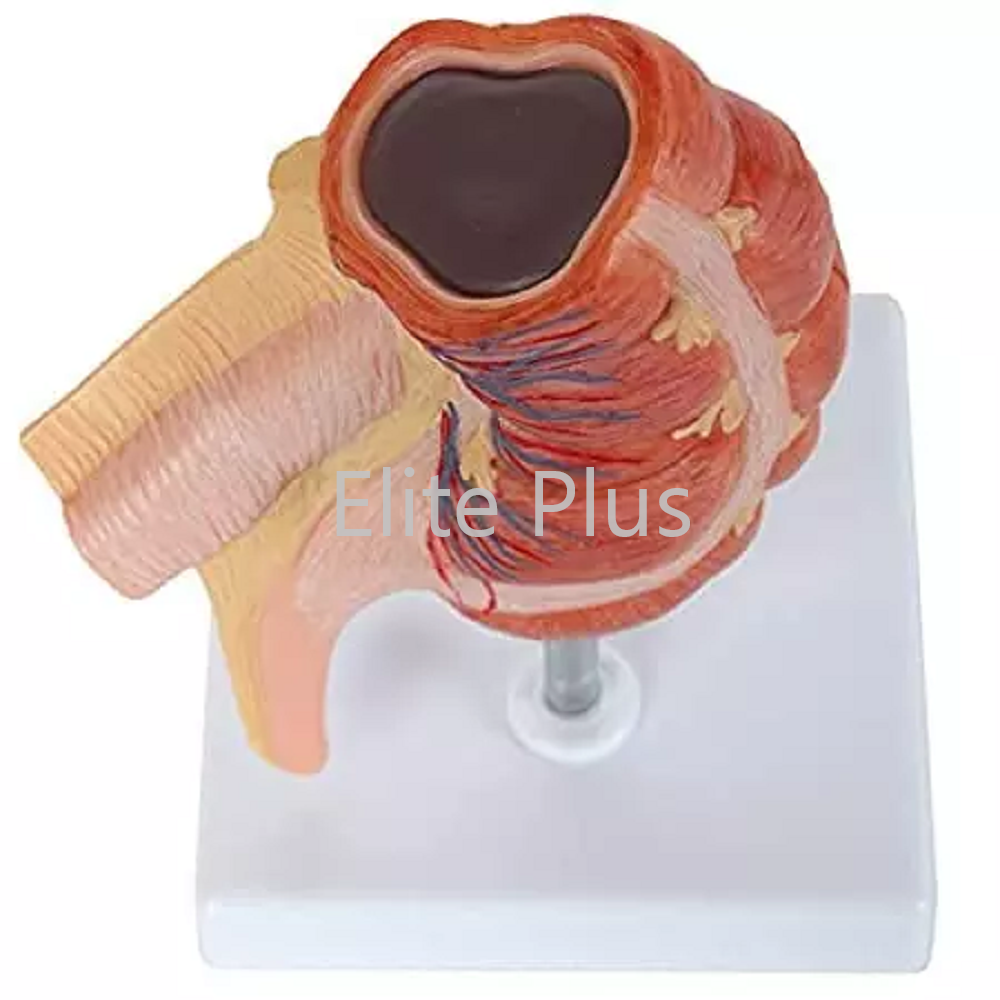 Zx-1434p Caecum And Appendix, Enlarged