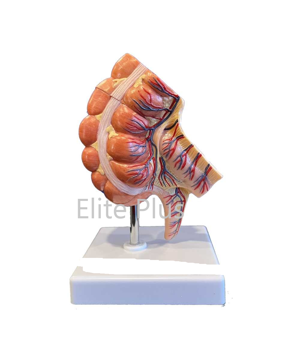 Zx-1434p Caecum And Appendix, Enlarged
