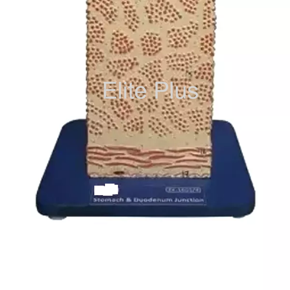 Stomach & Duodenum Junction Model - Pvc Material, 16x16x38 Cm Dimensions | Multicolor Design, 17 Educational Features For Nursing And Medical Colleges