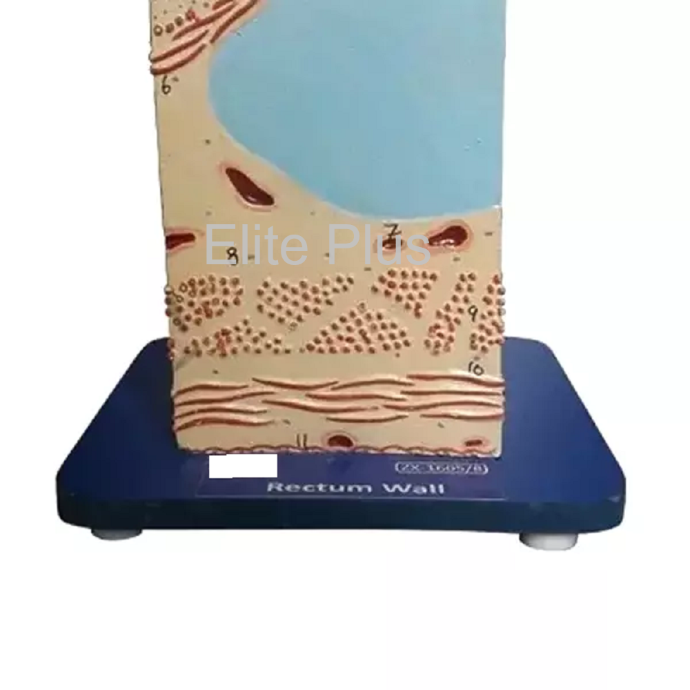Zx-1605/8 Rectum Wall