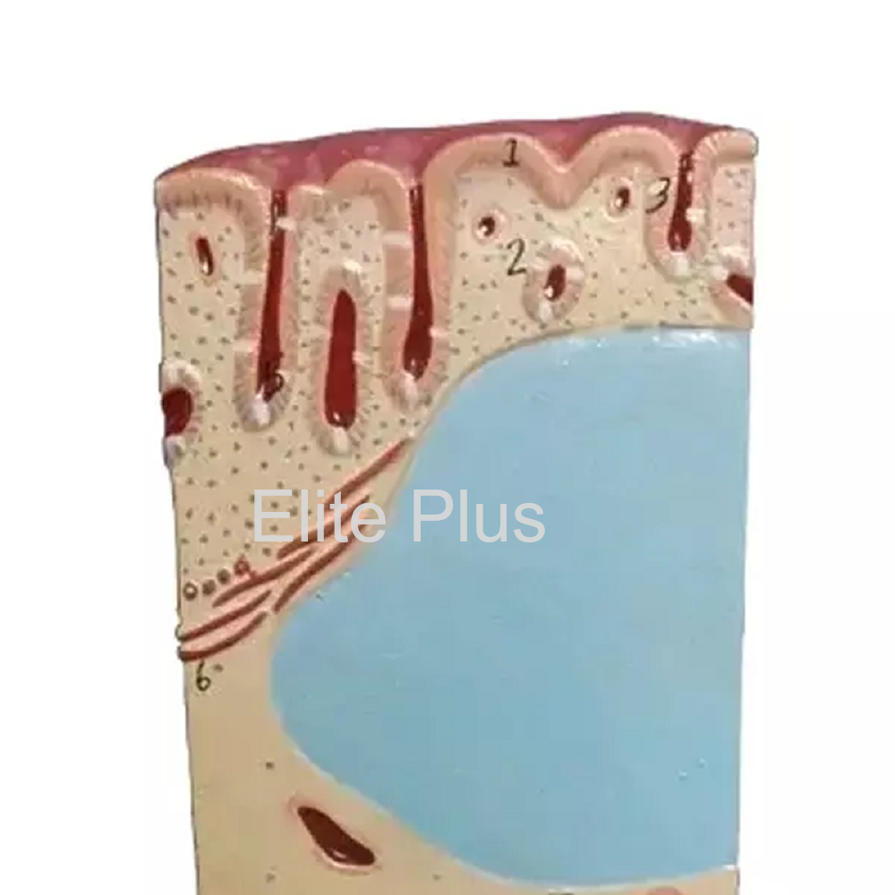 Zx-1605/8 Rectum Wall