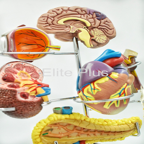 Zx-1511p Diabetes Mellitus Complications Model - Color: Multicolor