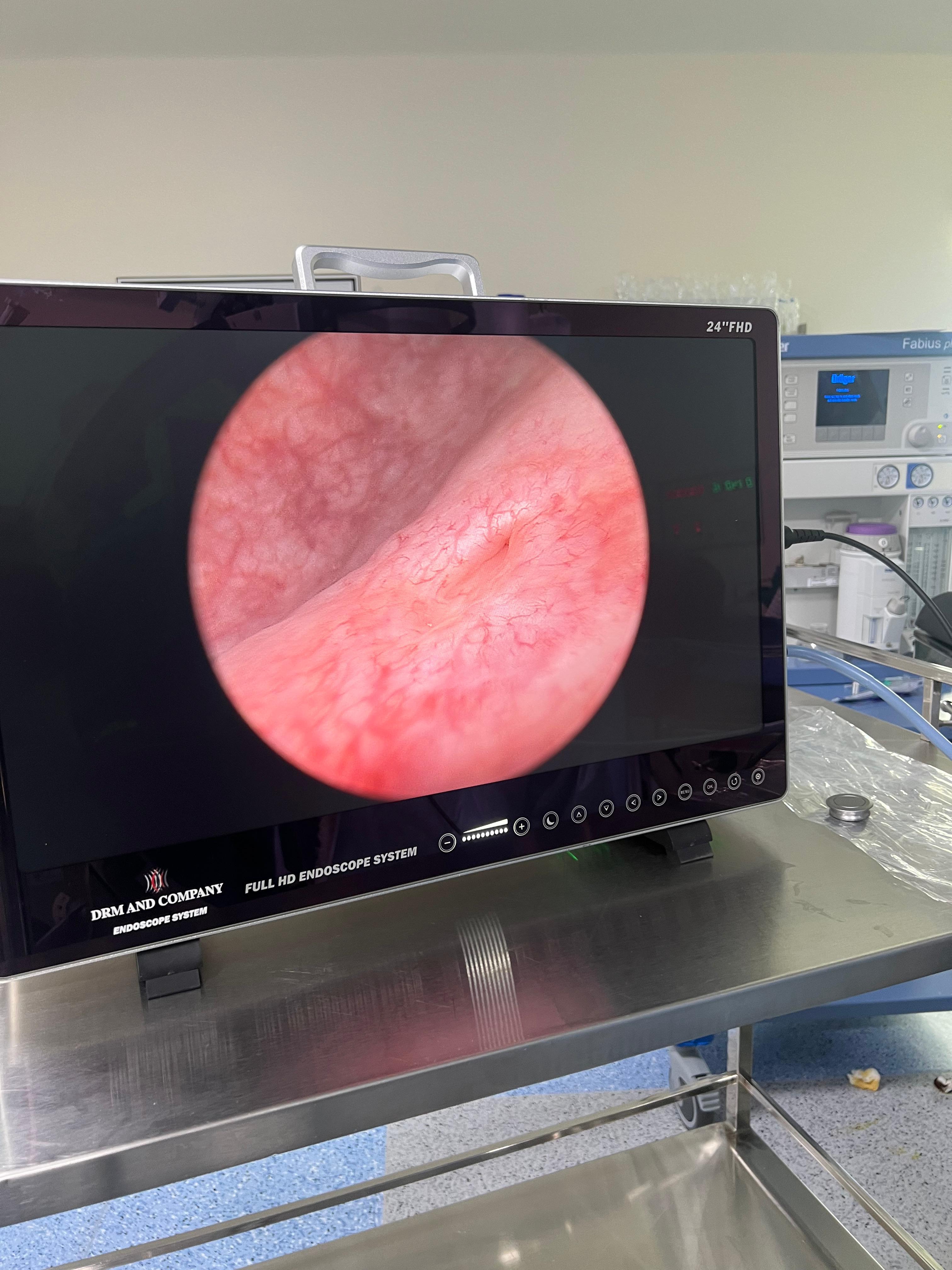 Medical Endoscopy Camera - Color Code: Grey