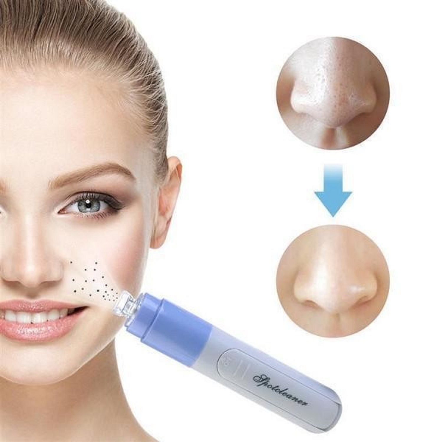 Vacuum Pore Cleaner - 4 Suction Heads With 2 Power Settings | Easy To Clean, Includes Small, Large, Oval, And Silicone Heads For Home Use