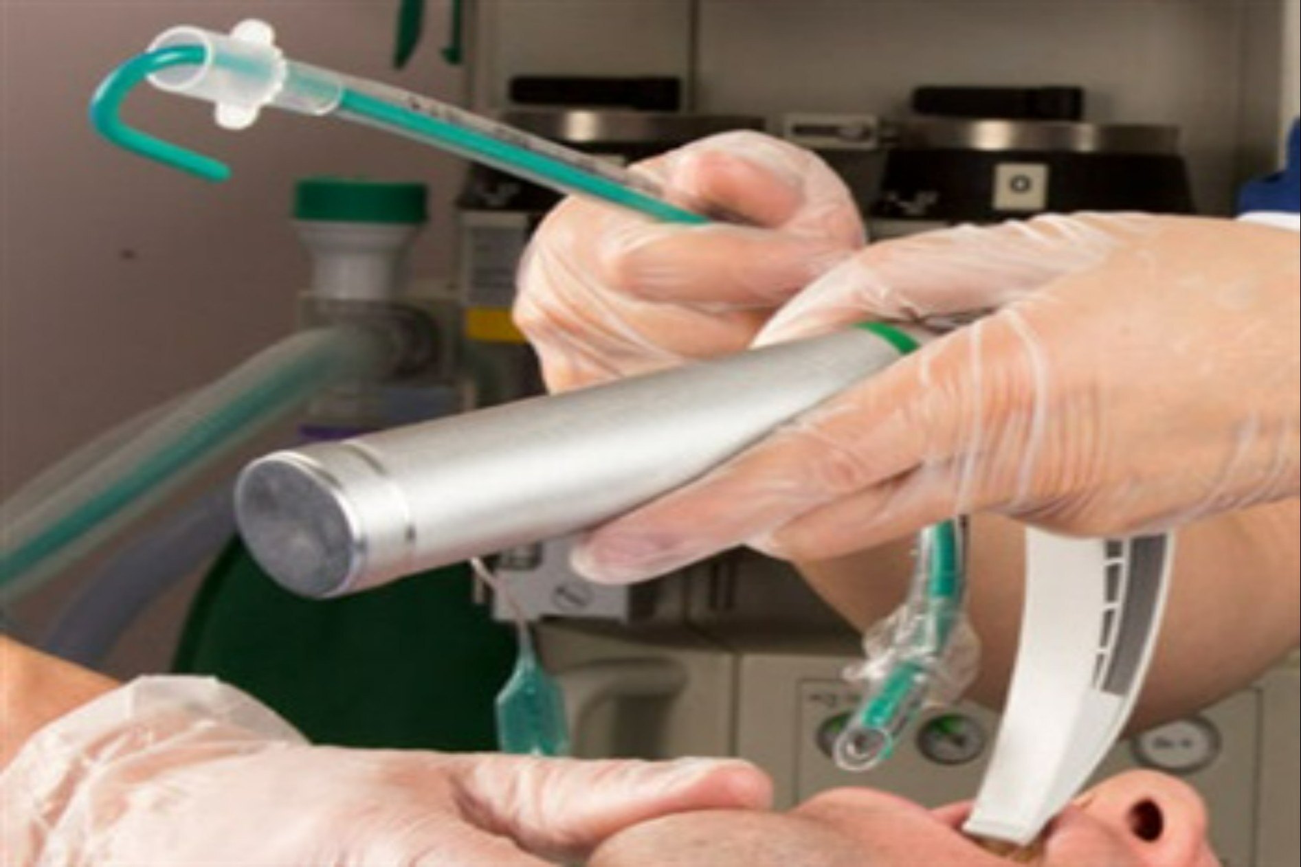 Intersurgical Interform Intubating Stylet - Malleable, Latex Free, Sterile, Single Use | Enables Custom Shaping For Enhanced Airway Control