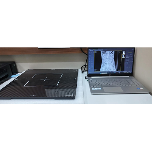 Retrofit Digital Radiography System - Material: Metal
