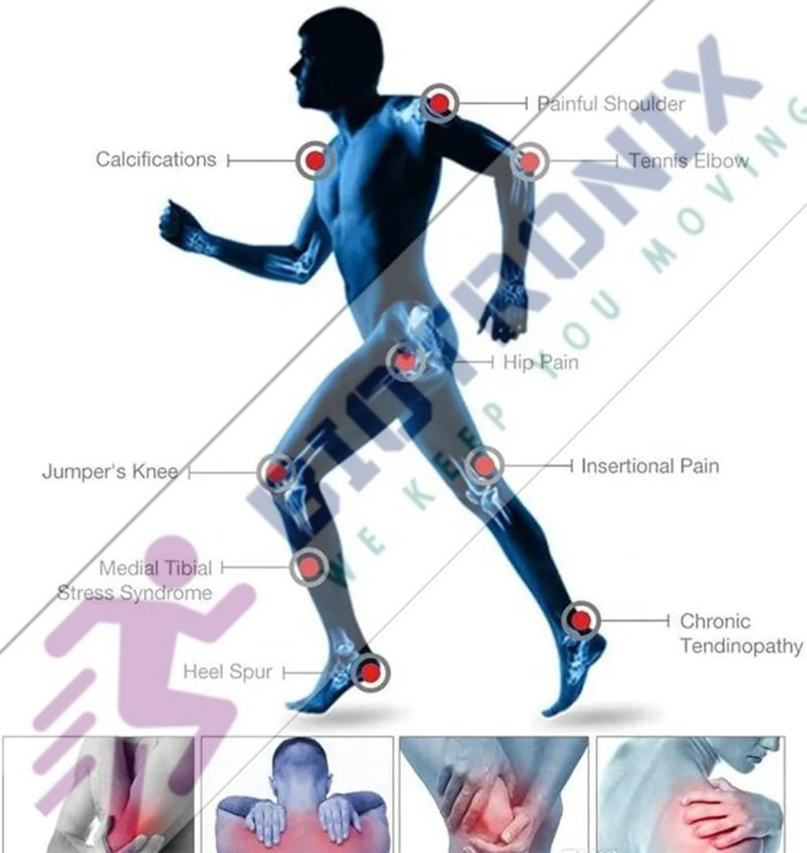 Shockwave Treatment Portable Device Digital Touch Screen Eswt Treatment, For Hospital