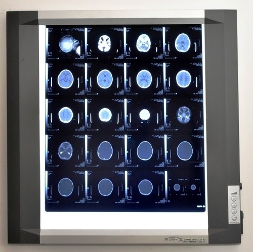 वन स्क्रीन एक्स - रे व्यूअर डार्कनेस रेंज: >10000