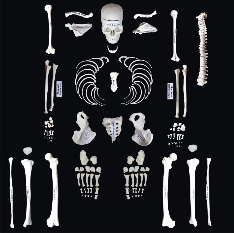Disarticulated Skeleton Model - Color: White