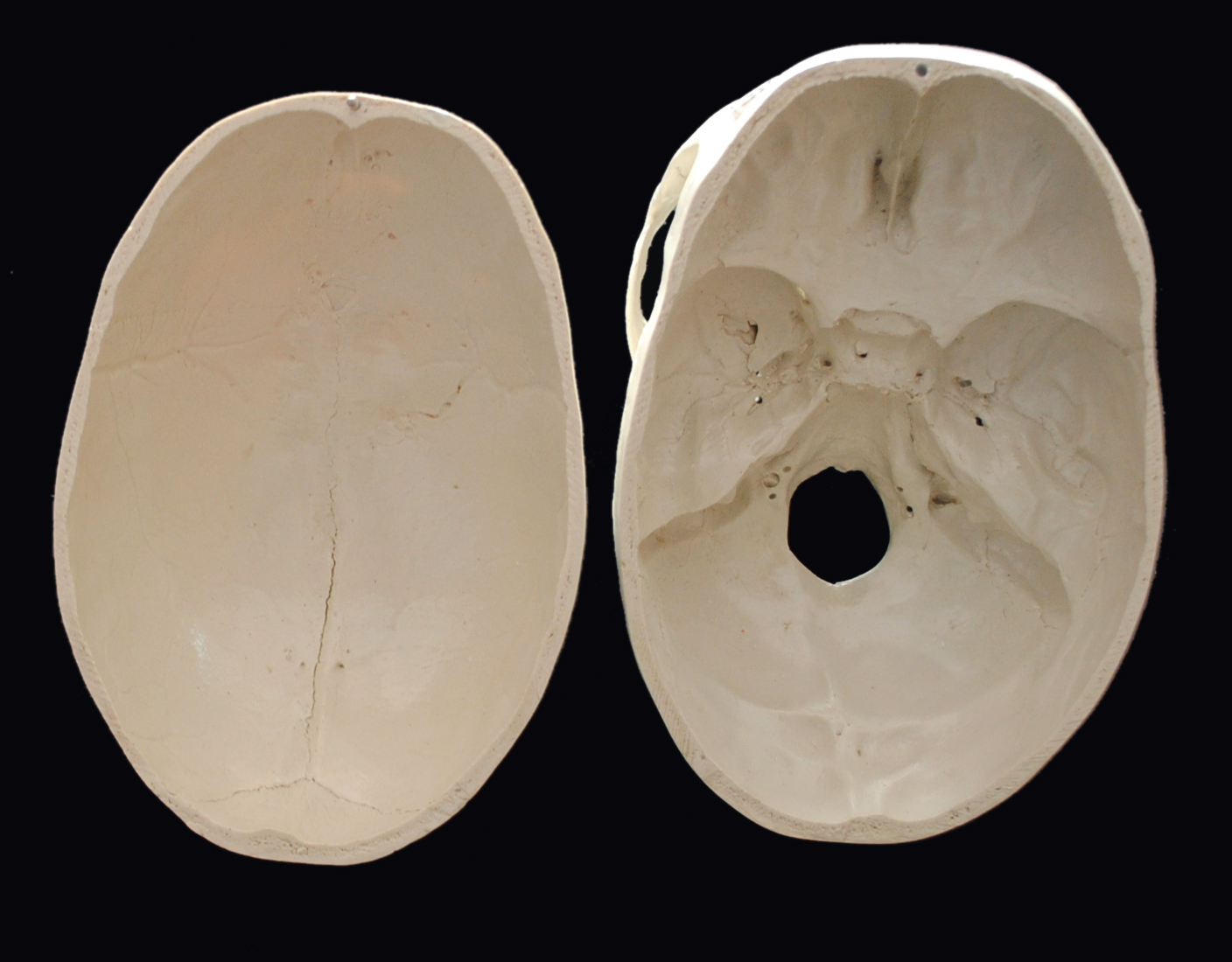 Skull Model - Pvc Material, Standard Size, White Color | Ideal For Nursing And Medical Colleges And Schools