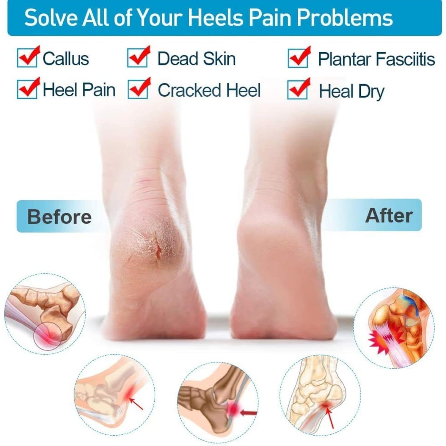 Anti-crack Silicone Half Gel Heel Protector - 7x6x1 Cm | Moisturizing Socks For Cracked Heels Instant Relief And Comfort For Men And Women