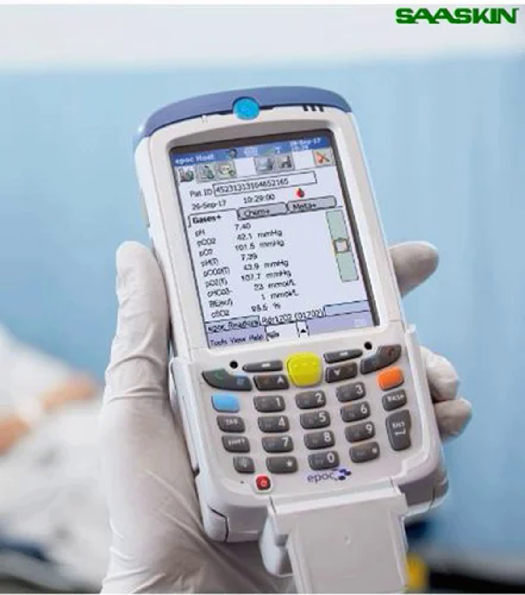 Siemens Epoc Blood Analysis System